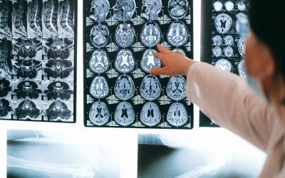 Neuropsicología en Córdoba: todo lo que debes saber
